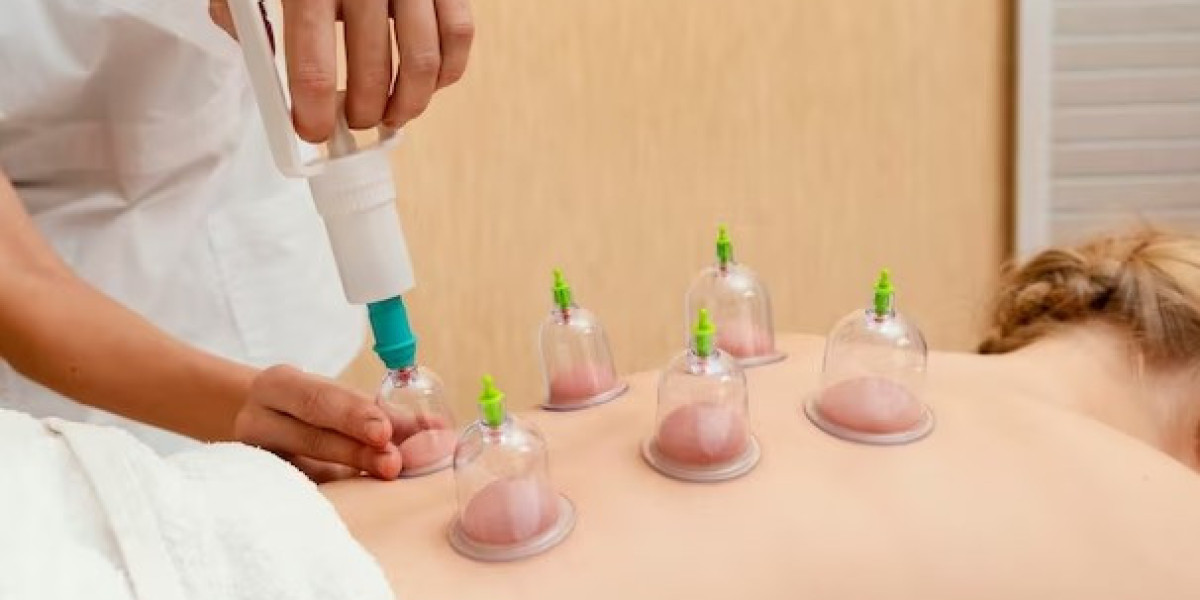 A Comprehensive Guide to Moxibustion Treatment in Singapore