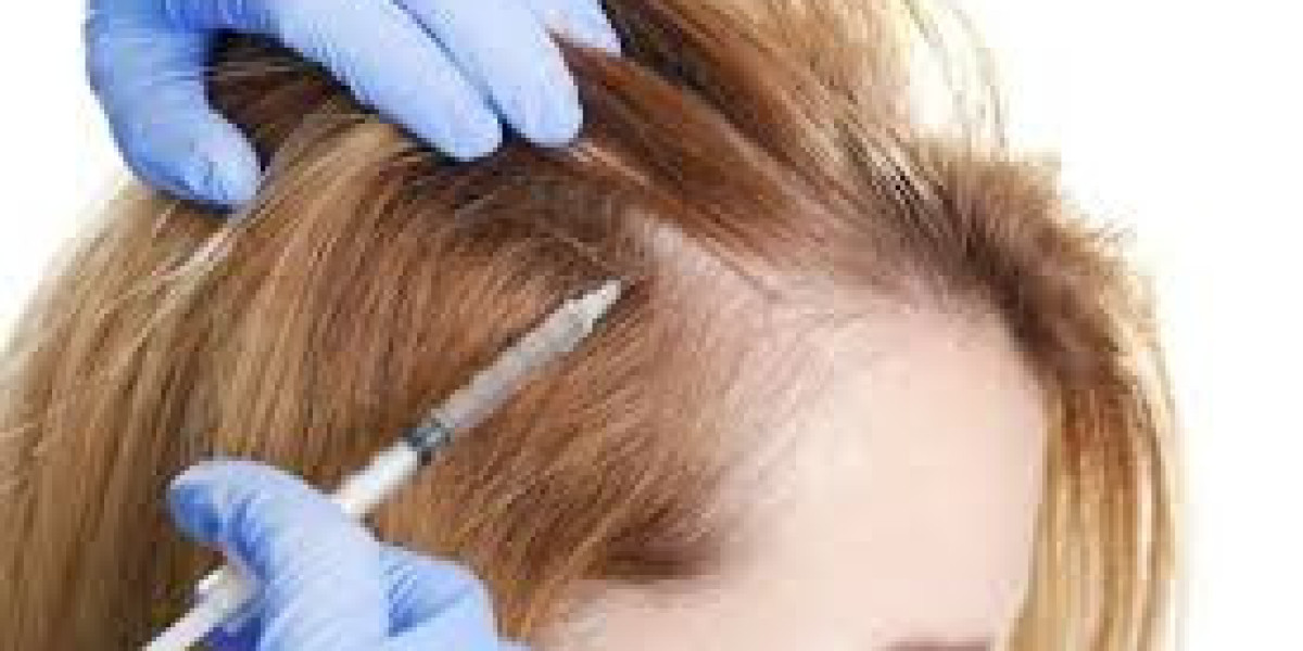Dubai’s Leading PRP Hair Treatment Clinics