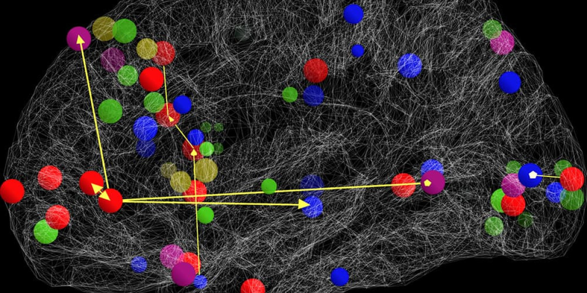 How NeuroMatch is Enhancing Brain Health Research