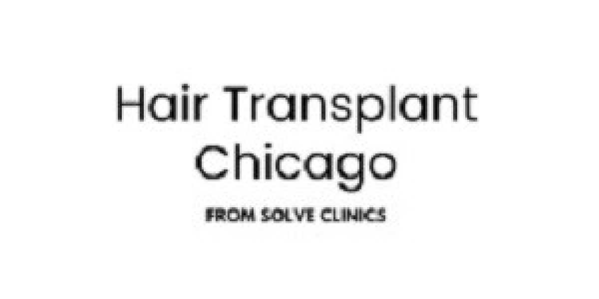 Hair Transplant Chicago