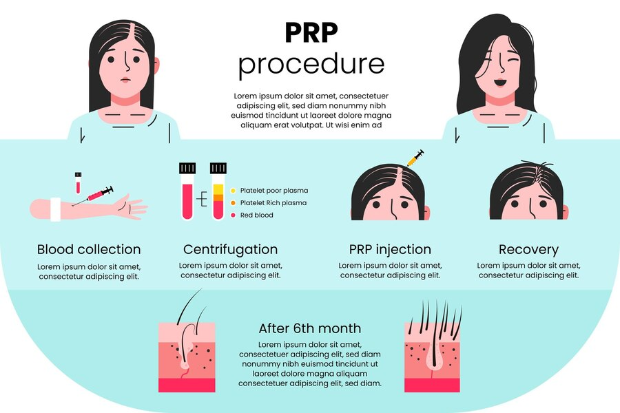 Best Prp Treatment In Bangalore