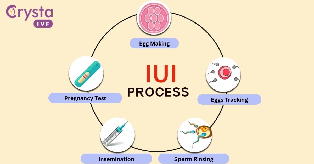 Can IUI treatment boost your chances of a successful pregnancy?