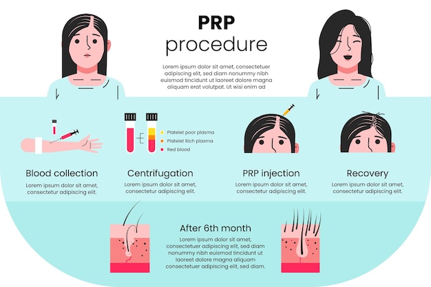 Best Prp Treatment In Bangalore - WriteUpCafe.com