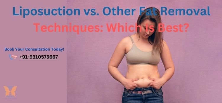 Liposuction vs. Other Fat Removal Techniques: Which Is the Best Choice?