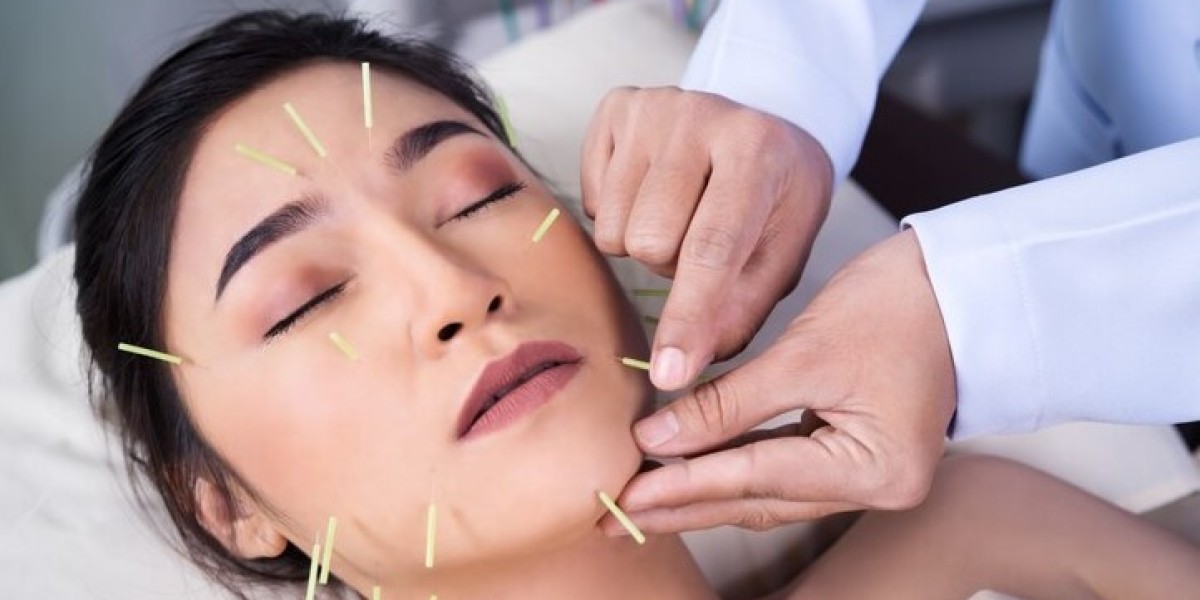 Turn Back Time with Acupuncture Face Lift Treatments