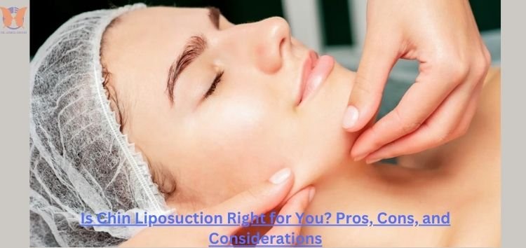 Is Chin Liposuction the Best Choice? Key Pros, Cons, and Tips